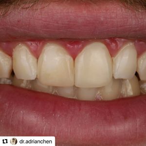 Image post by @ripeglobal on Instagram