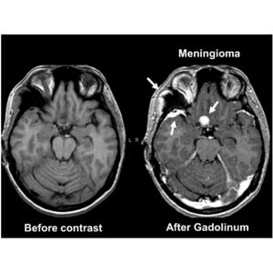 Image post by @imagecareradiology on Instagram