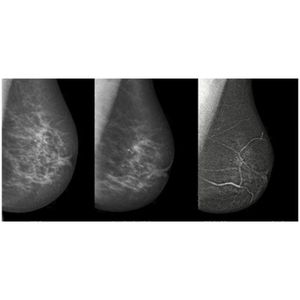 Image post by @imagecareradiology on Instagram