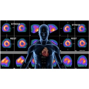 Image post by @imagecareradiology on Instagram