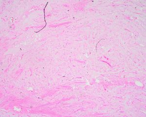 Image post by @vumcpathology on Instagram