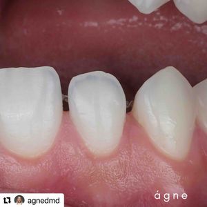 Image post by @ripeglobal on Instagram