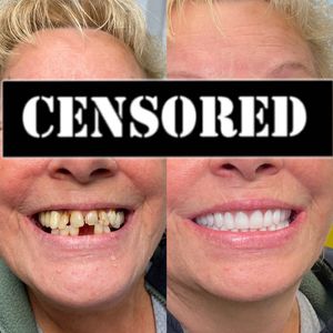Image post by @islanddentalny on Instagram