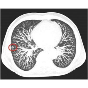 Image post by @imagecareradiology on Instagram