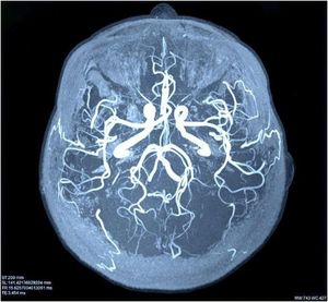 Image post by @imagecareradiology on Instagram
