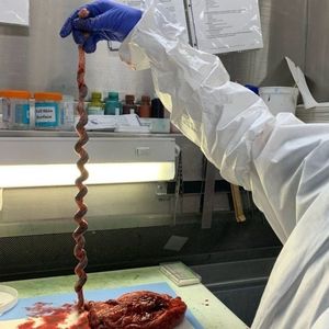 Image post by @vumcpathology on Instagram