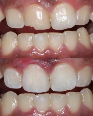 Image post by @islanddentalny on Instagram