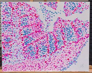 Image post by @vumcpathology on Instagram