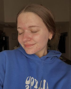 Image post by @your.skinsbestie on Instagram