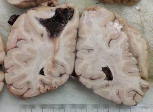 Image post by @vumcpathology on Instagram
