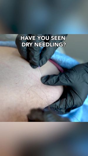 Video post by @TenderCareRehabilitationWellnessCenter on Facebook