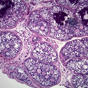 Image post by @vumcpathology on Instagram