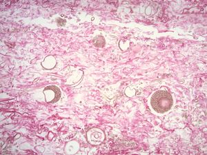Image post by @vumcpathology on Instagram
