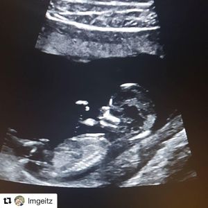 Image post by @aussiediamonds on Instagram