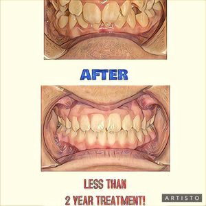 Image post by @new_smile_ortho on Instagram