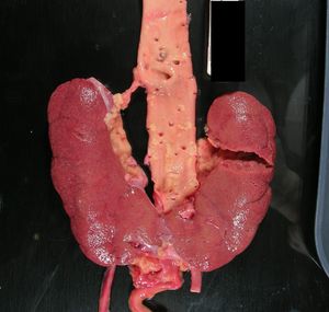 Image post by @vumcpathology on Instagram