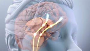 Video post by @nucleusmedicalmedia on YouTube