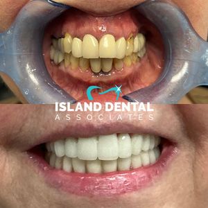 Image post by @islanddentalny on Instagram