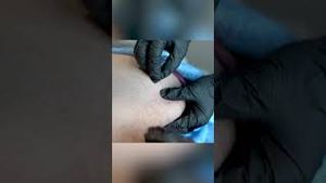 Video post by @tendercarerehab on YouTube