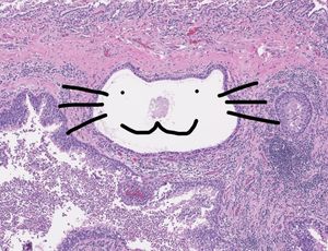 Image post by @vumcpathology on Instagram