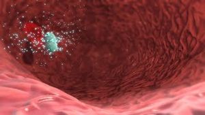 Video post by @nucleusmedicalmedia on YouTube