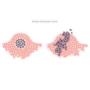 Image post by @imagecareradiology on Instagram