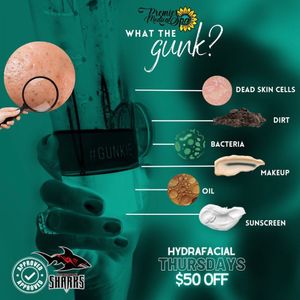 Image post by @jaxsharks on Instagram