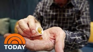 Video post by @today on YouTube