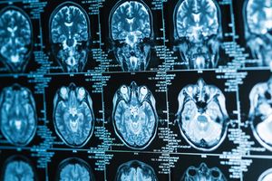 Image post by @imagecareradiology on Instagram