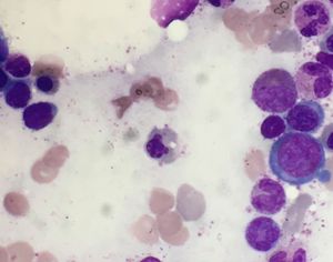 Image post by @vumcpathology on Instagram
