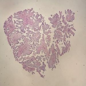 Image post by @vumcpathology on Instagram