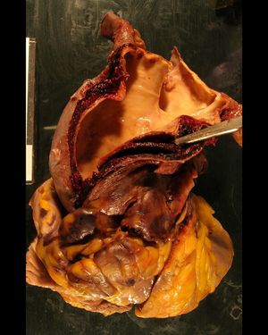 Image post by @vumcpathology on Instagram