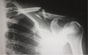 Image post by @imagecareradiology on Instagram